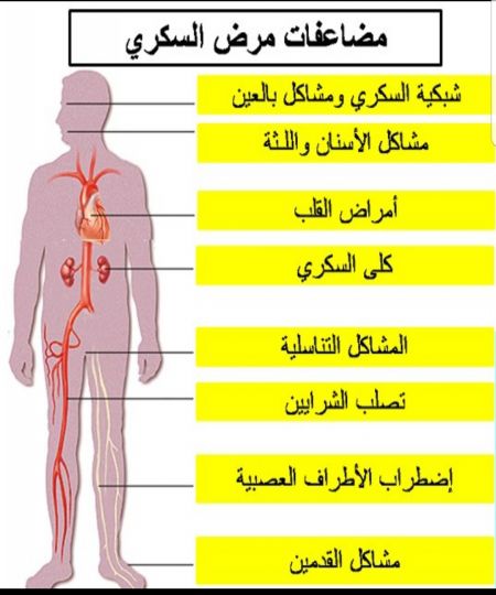      

حذّر أطباء متخصصون في علاج ”السكري”، من خ...