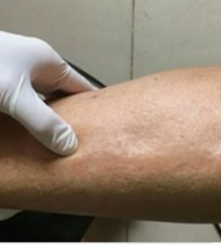 ? طرق استخراج الماء الزائد من الجسم :

? يتسبب الم...