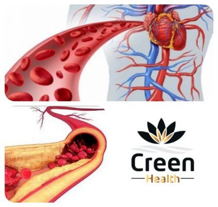 ما هو انسداد الشرايين؟
?

ينتج انسداد الشرايين...