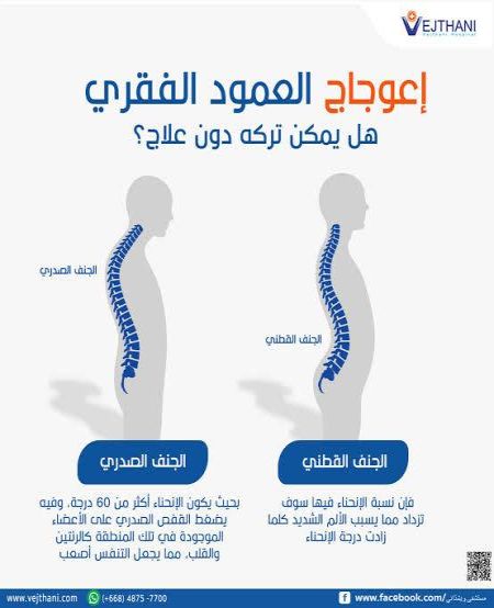 انواع اعوجاج العمود الفقري