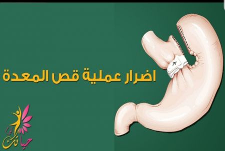 عملية تكميم المعدة كما هو الحال مع أي عملية جراحية...